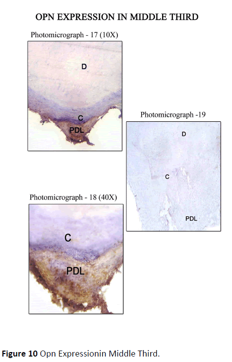 periodontics-prosthodontics-Expressionin-Middle