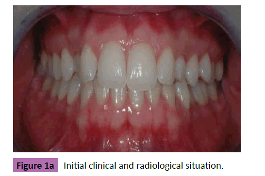 periodontics-prosthodontics-Initial-clinical