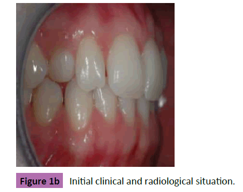 periodontics-prosthodontics-Initial-clinical-radiological