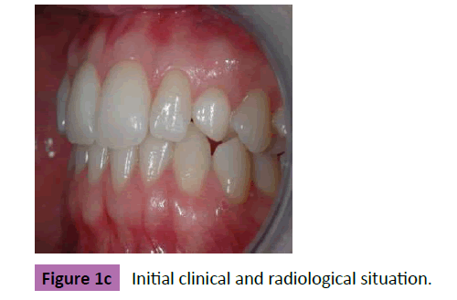periodontics-prosthodontics-Initial-radiological