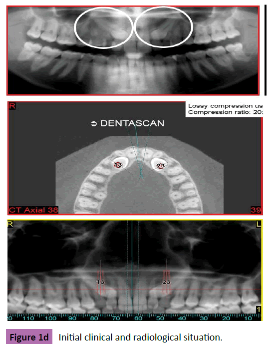 periodontics-prosthodontics-Initial-situation