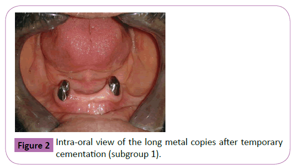 periodontics-prosthodontics-Intra-oral-view