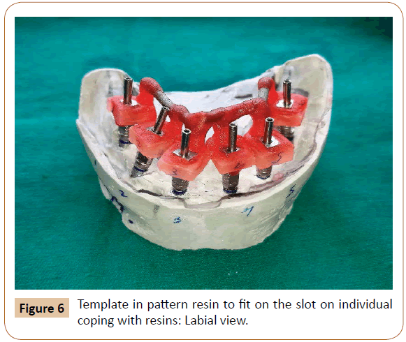periodontics-prosthodontics-Labial-view