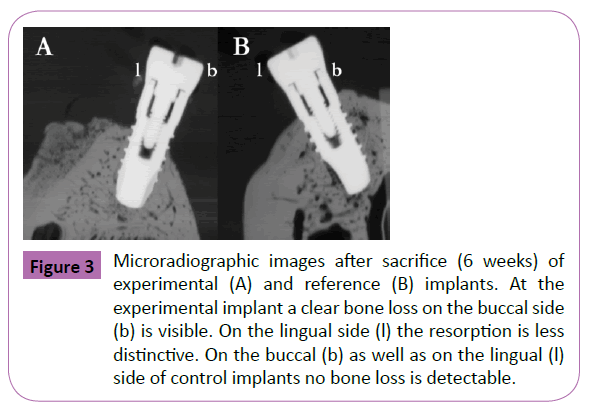 periodontics-prosthodontics-Microradiographic