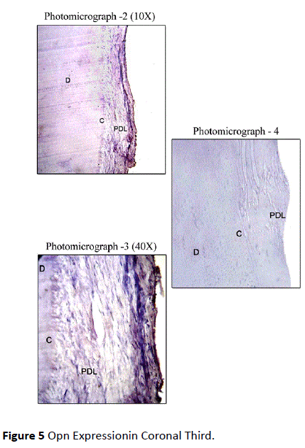 periodontics-prosthodontics-Opn-Expressionin