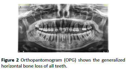 periodontics-prosthodontics-Orthopantomogram