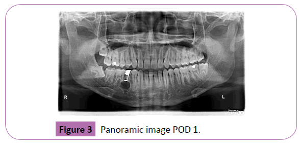 periodontics-prosthodontics-Panoramic-image