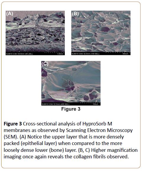 periodontics-prosthodontics-Scanning-Electron