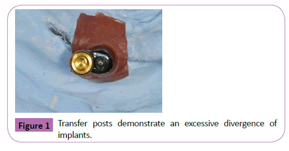 periodontics-prosthodontics-Transfer-posts