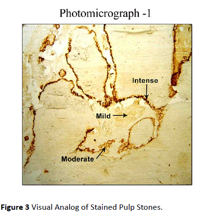 periodontics-prosthodontics-Visual-Analog