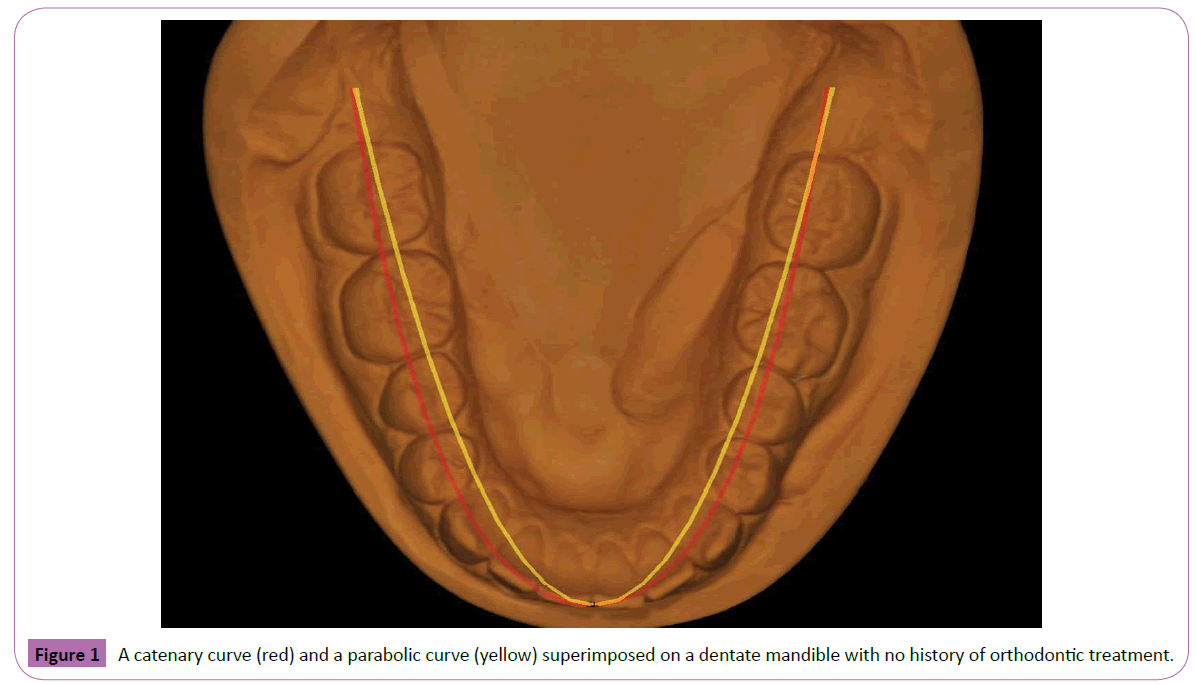 periodontics-prosthodontics-catenary-curve