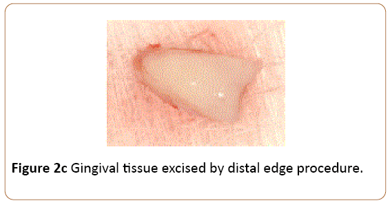 periodontics-prosthodontics-distal-edge