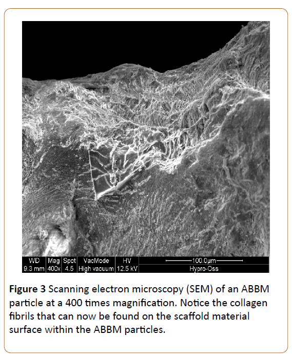 periodontics-prosthodontics-electron-microscopy