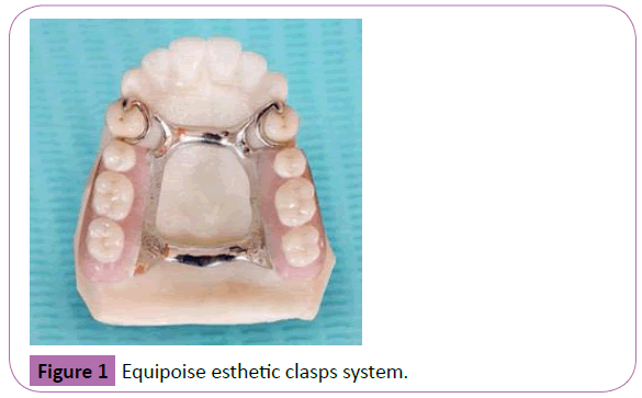 periodontics-prosthodontics-esthetic-clasps
