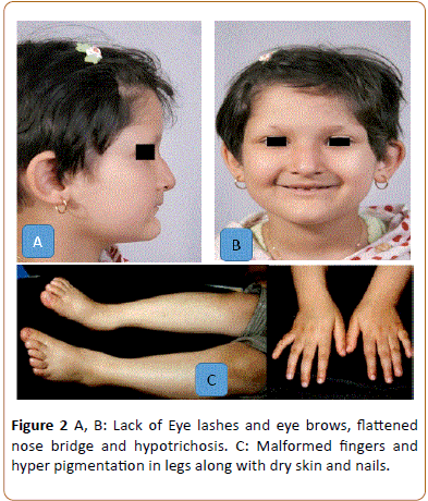 periodontics-prosthodontics-eye-brows