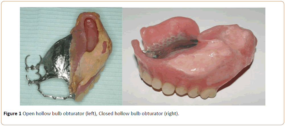 periodontics-prosthodontics-hollow-bulb