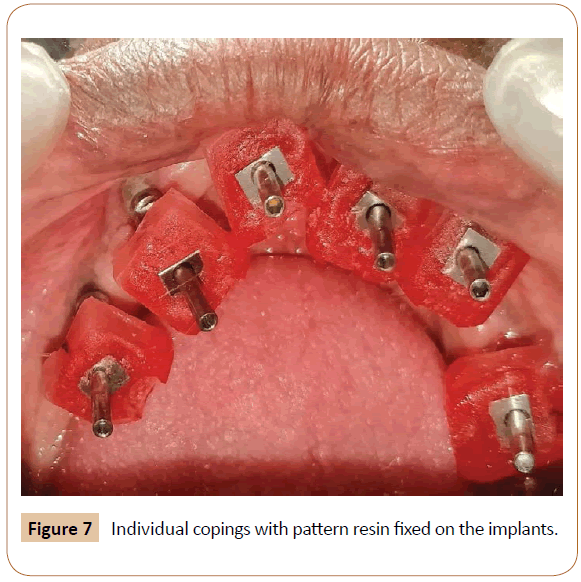 periodontics-prosthodontics-implants