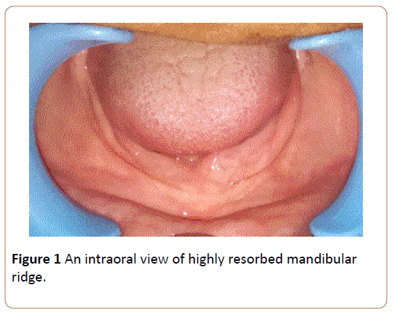 periodontics-prosthodontics-intraoral-view