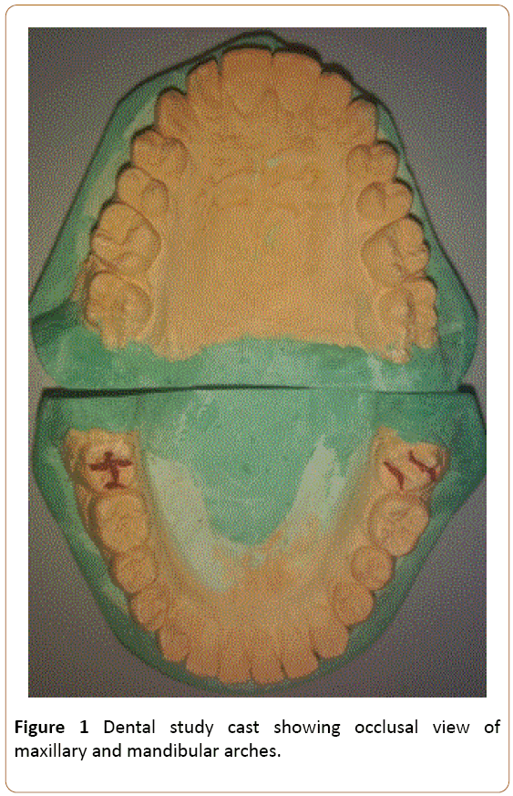 periodontics-prosthodontics-mandibular-arches