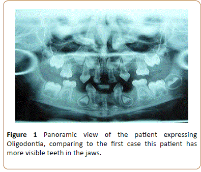 periodontics-prosthodontics-panoramic