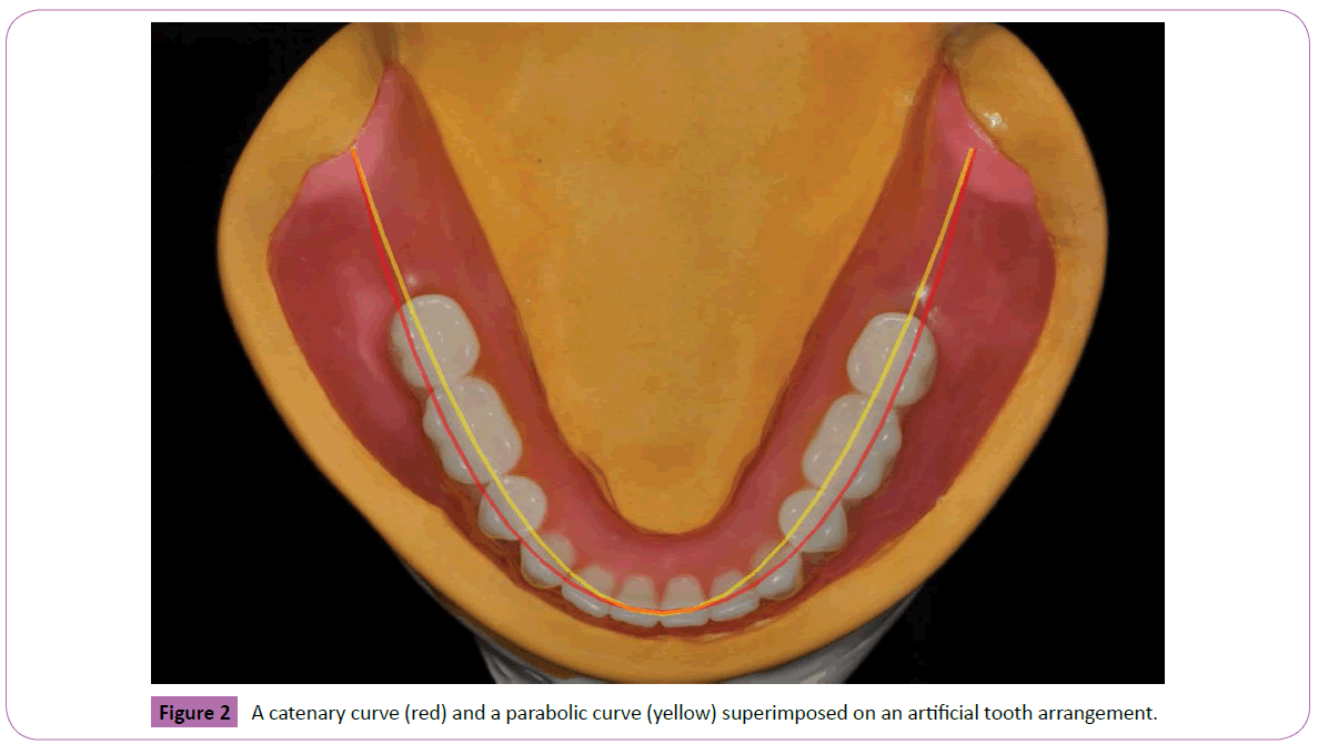 periodontics-prosthodontics-parabolic-curve