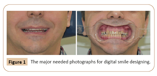 periodontics-prosthodontics-photographs