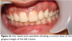 periodontics-prosthodontics-post-operative-correct