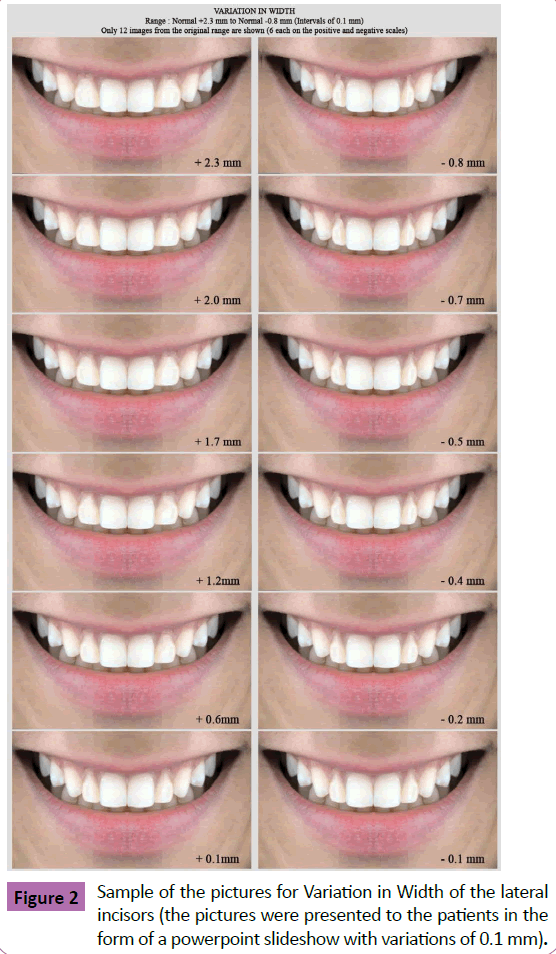 periodontics-prosthodontics-powerpoint-slideshow
