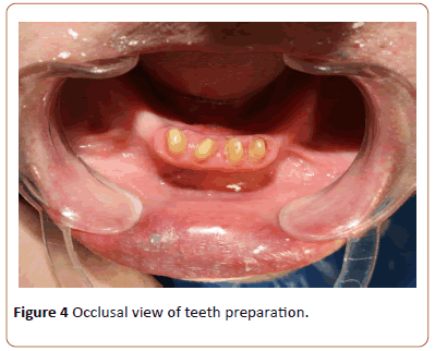 periodontics-prosthodontics-preparation