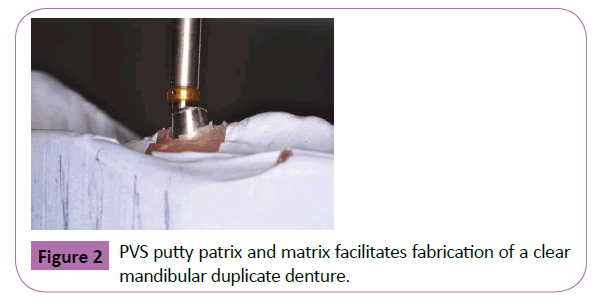 periodontics-prosthodontics-putty-patrix