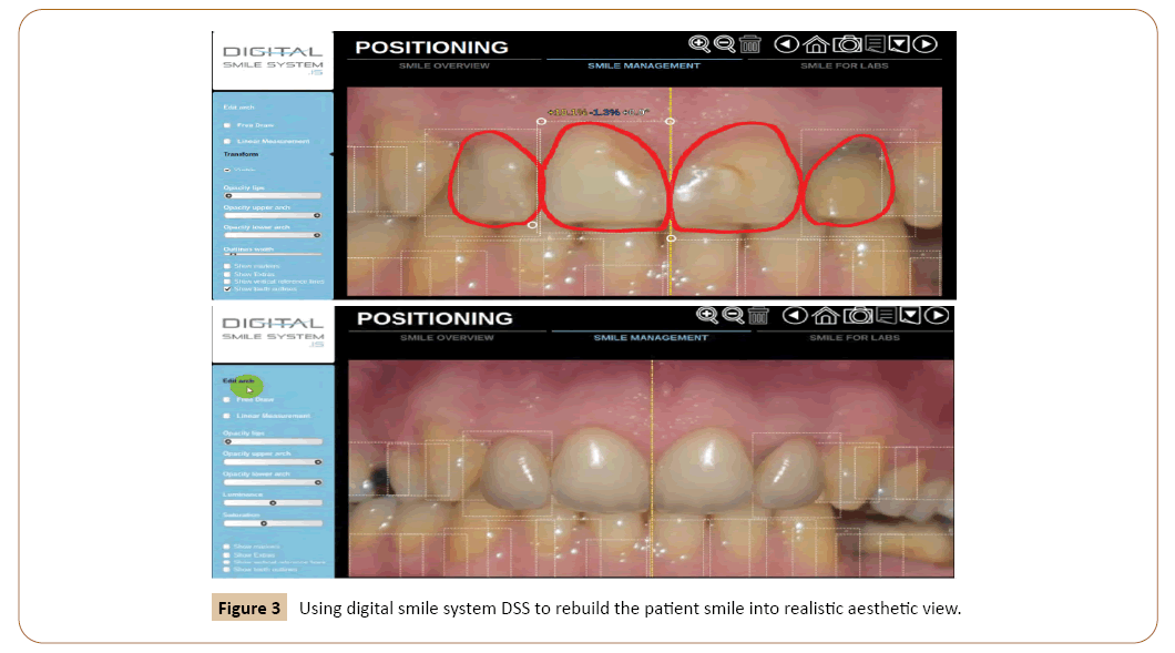 periodontics-prosthodontics-realistic