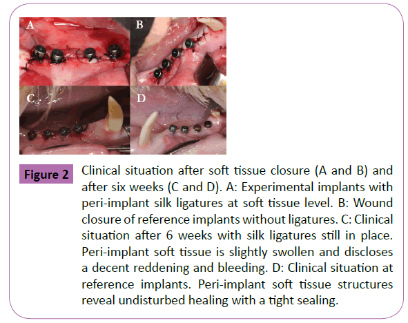 periodontics-prosthodontics-soft-tissue