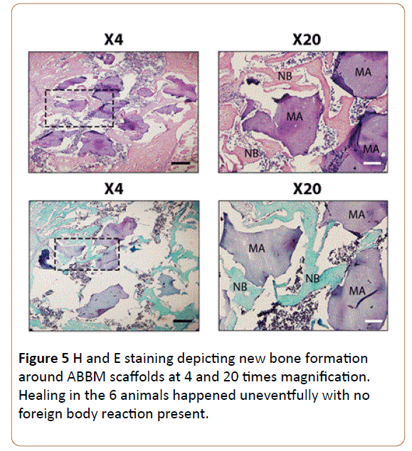 periodontics-prosthodontics-staining-depicting