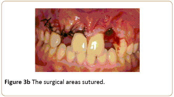 periodontics-prosthodontics-surgical-areas