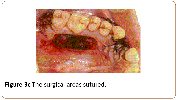 periodontics-prosthodontics-surgical-areas