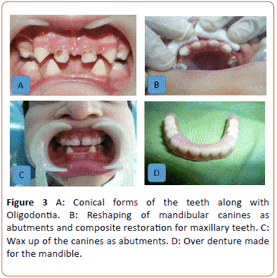periodontics-prosthodontics-teeth