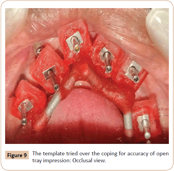 periodontics-prosthodontics-template