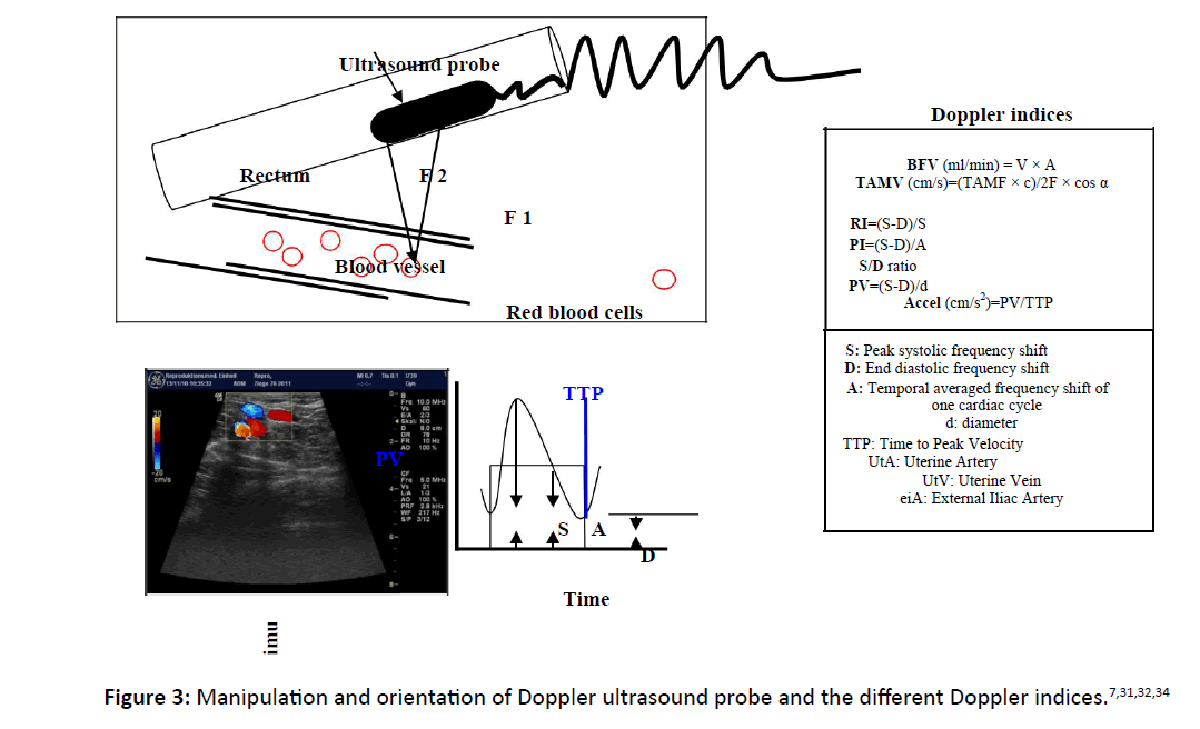 primarycare-Doppler-indices