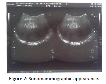primarycare-Sonomammographic