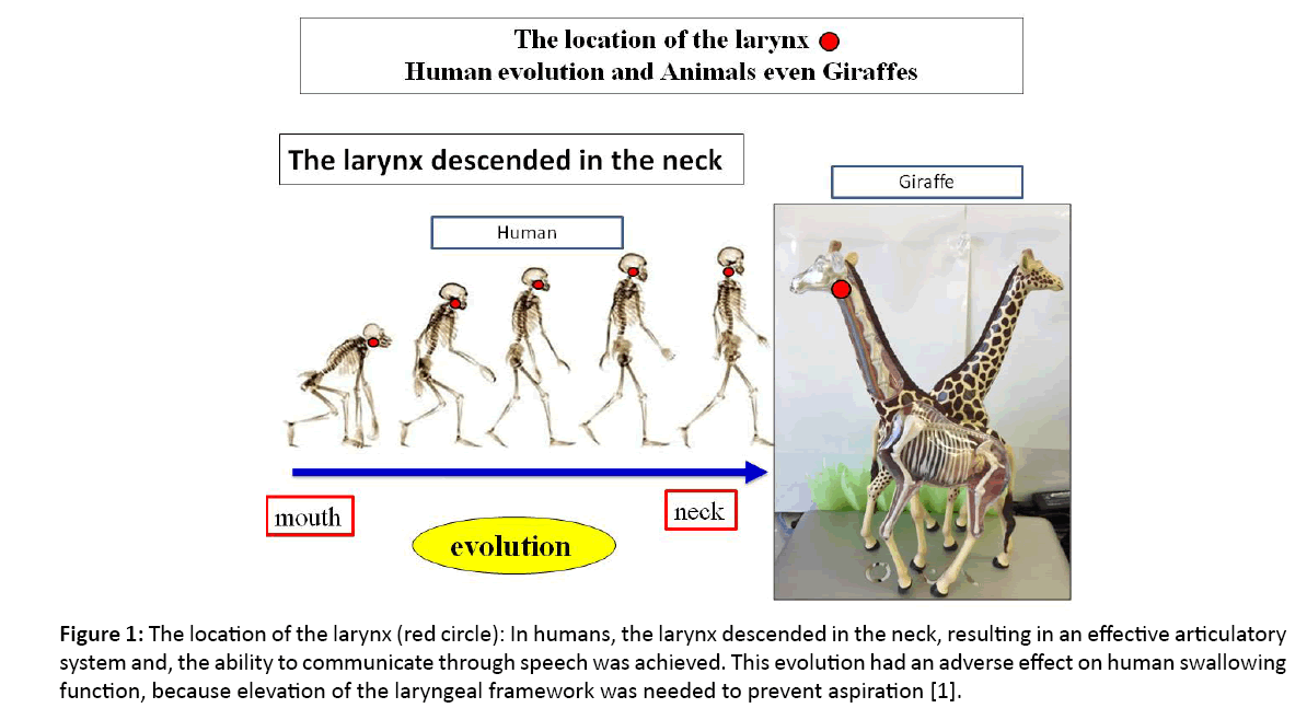 primarycare-larynx