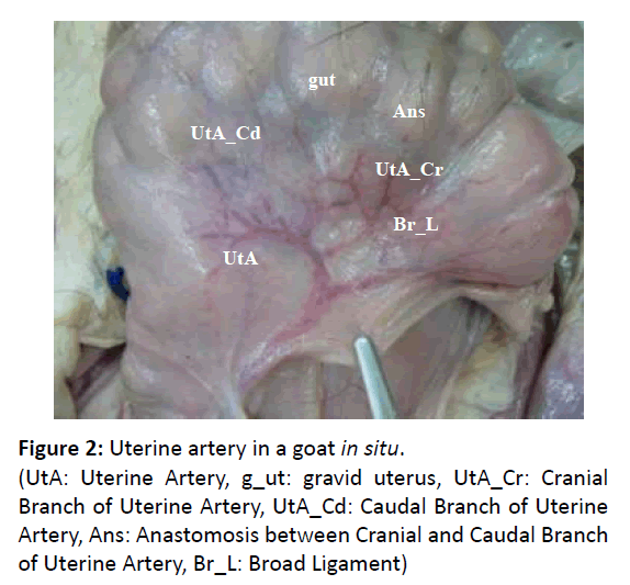 primarycare-utero-artery