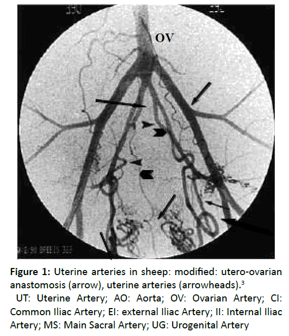 primarycare-utero-ovarian