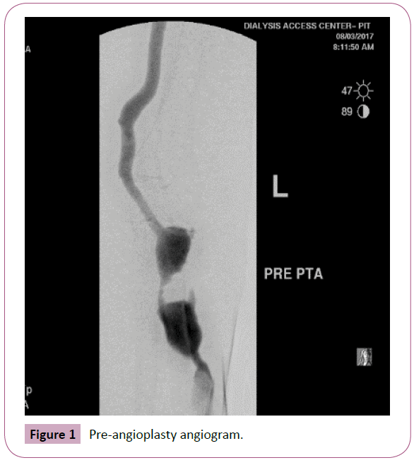 psychopathology-angiogram