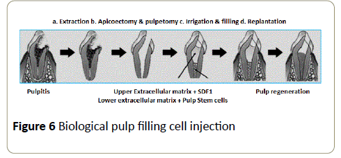 stemcells-Biological-pulp-filling