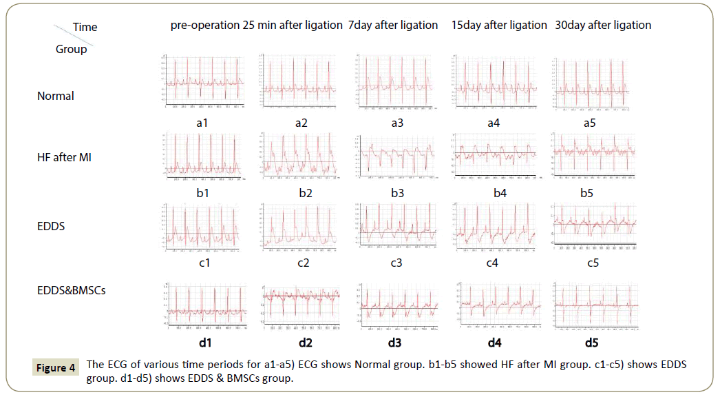 stemcells-ECG-various-time-periods