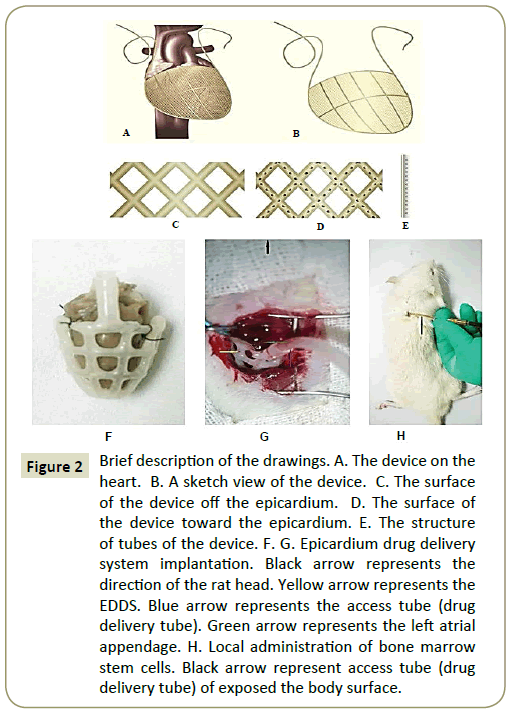 stemcells-Epicardium-drug-delivery