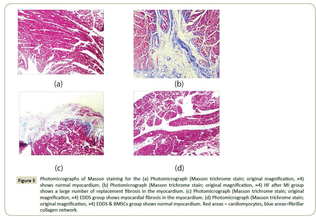 stemcells-Photomicrographs-Masson-staining