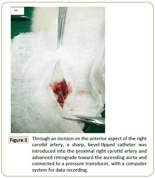 stemcells-incision-anterior-aspect