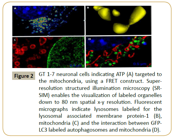 stemcells-neuronal-cells