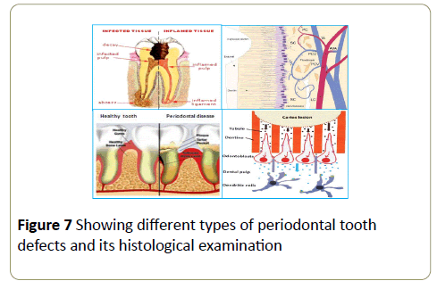 stemcells-periodontal-tooth